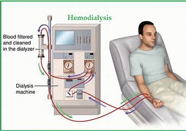 Dialyzers